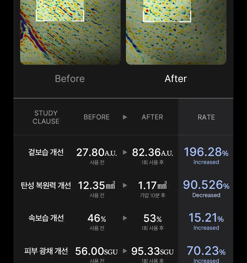 [7월 올영픽][한교동 장바구니백 증정] 메디큐브 에이지알 미니플러스 한교동 에디션/짱구 에디션/핑크/베이지 택 1 상세페이지 71